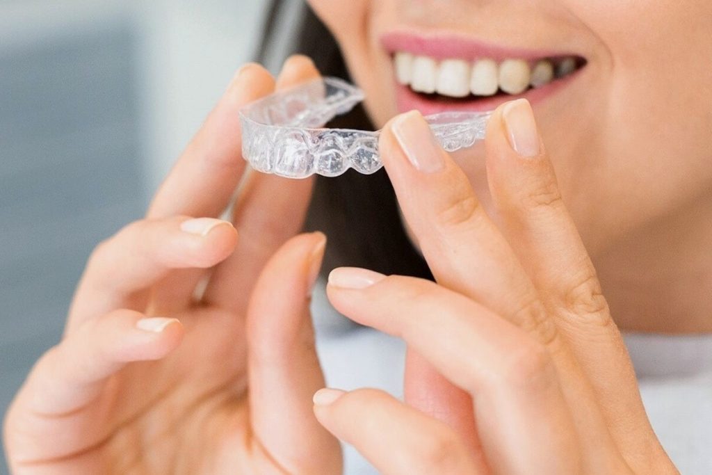 woman about to wear her aligner