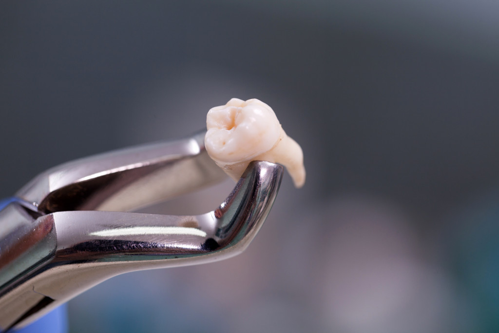 a dental tool holding an extracted tooth