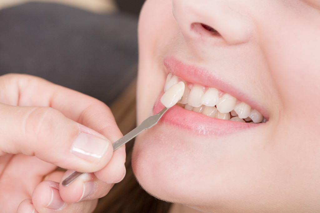 Woman getting veneers