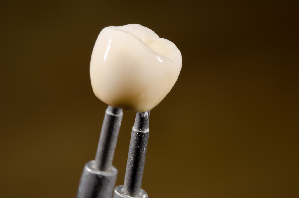 Image of a dental implant