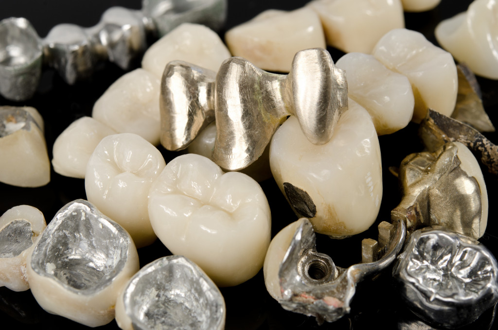 dental bridges and crowns